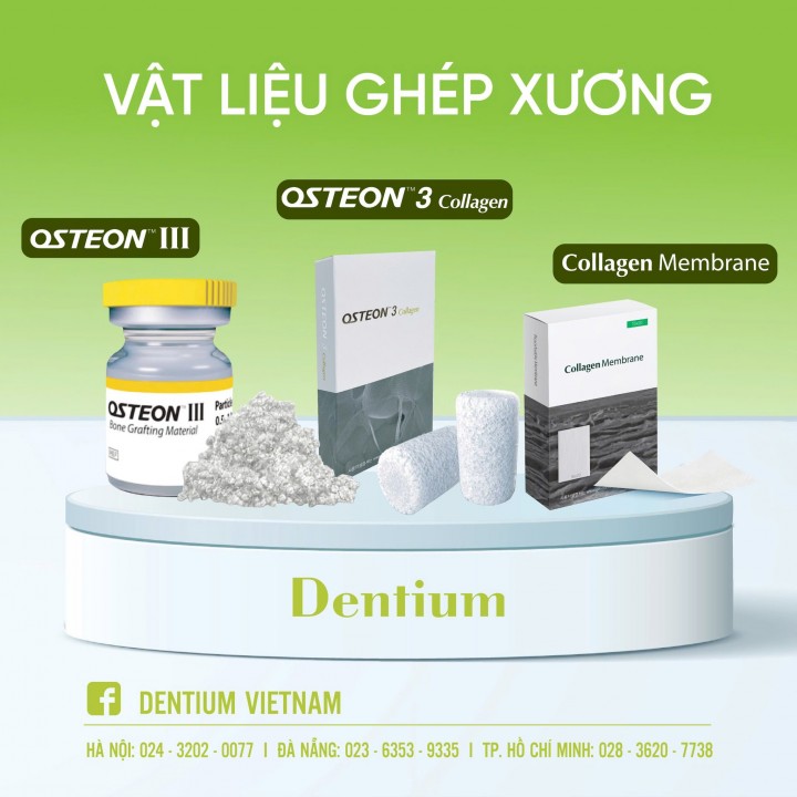 GHÉP XƯƠNG LÀ GÌ VÀ KHI NÀO PHẢI GHÉP XƯƠNG ?